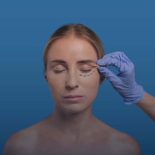 Badem Göz Estetiği