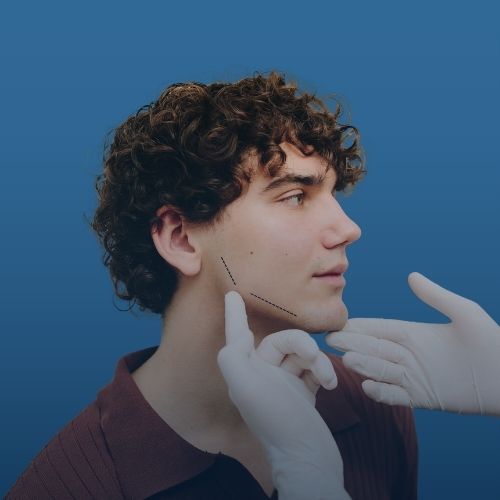 Çene ve Yüz İmplantı