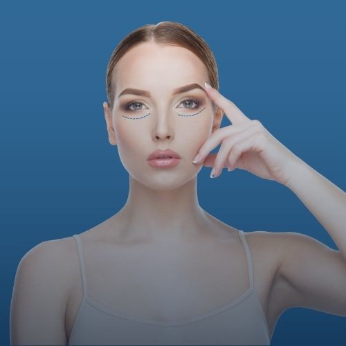 Göz Altı Işık Dolgusu