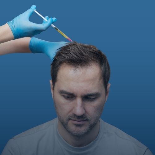 Saç Mezoterapisi