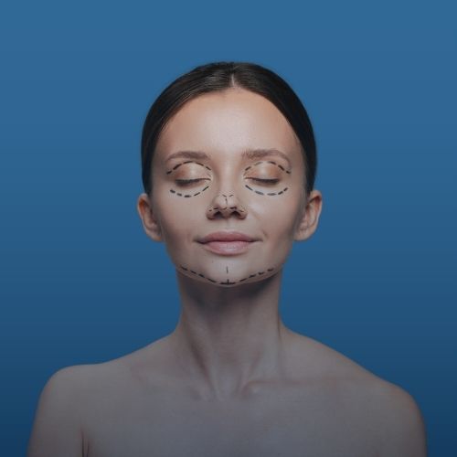 Yüz Feminizasyon Cerrahisi